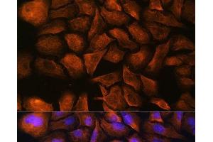 Immunofluorescence analysis of U-2 OS cells using SPTAN1 Polyclonal Antibody at dilution of 1:100.