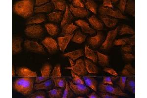 Immunofluorescence analysis of U-2 OS cells using SPTAN1 Polyclonal Antibody at dilution of 1:100. (SPTAN1 anticorps)