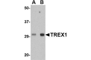 Western blot analysis of TREX1 in human spleen tissue lysate with this product at (A) 0. (TREX1 anticorps  (Center))