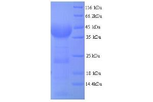 SDS-PAGE (SDS) image for Malic Enzyme Complex, Mitochondrial (Mod2) (AA 1084-1419) protein (His tag) (ABIN5714020)