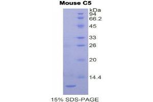 SDS-PAGE (SDS) image for Complement Component 5 (C5) (AA 679-755) protein (His tag) (ABIN1880096)