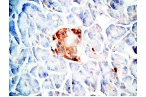 Human pancreas cancer tissue was stained by Rabbit Anti-Oxyntomodulin (H,M,R) Antibody (OXM anticorps)