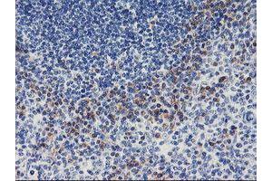 Immunohistochemical staining of paraffin-embedded Human tonsil using anti-ALG2 mouse monoclonal antibody. (ALG2 anticorps)