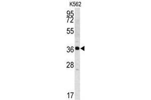 Western blot analysis of Kallikrein 2 (KLK2) Antibody (C-term) in K562 cell line lysates (35ug/lane). (Kallikrein 2 anticorps  (C-Term))