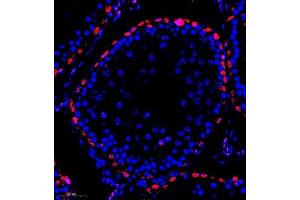 Immunofluorescence of paraffin embedded rat testis using MED17 (ABIN7074579) at dilution of 1:600 (300x lens) (MED17 anticorps)