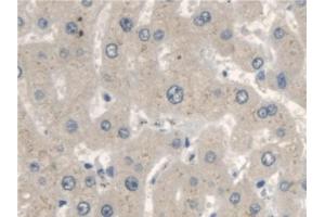 Detection of OXCT1 in Human Liver Tissue using Polyclonal Antibody to 3-Oxoacid Coenzyme A Transferase 1 (OXCT1) (OXCT1 anticorps  (AA 40-489))