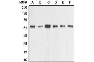 Western blot analysis of MMP1 expression in HeLa (A), MCF7 (B), MDAMB435 (C), Raw264.