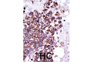 Immunohistochemistry (IHC) image for anti-Calcium/calmodulin-Dependent Protein Kinase I (CAMK1) antibody (ABIN3003045) (CAMK1 anticorps)