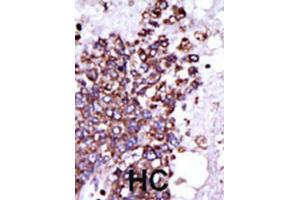 Immunohistochemistry (IHC) image for anti-Calcium/calmodulin-Dependent Protein Kinase I (CAMK1) antibody (ABIN3003045)