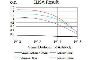 Black line: Control Antigen (100 ng), Purple line: Antigen(10 ng), Blue line: Antigen (50 ng), Red line: Antigen (100 ng), (EGFR Mutant (AA 693-893) anticorps)