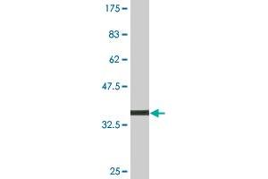 Western Blot detection against Immunogen (35.