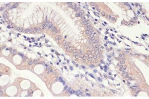 Immunohistochemistry of paraffin-embedded Human small intestine using HMGCR Polyclonal Antibody at dilution of 1:200 (40x lens). (HMGCR anticorps)