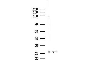 Western blot analysis of lysates from Rat brain, using HOXC4 Antibody at 1/1000 dilution.