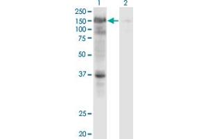 Western Blot analysis of USP4 expression in transfected 293T cell line by USP4 monoclonal antibody (M01), clone 5E12. (USP4 anticorps  (AA 676-773))