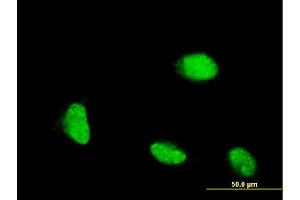 Immunofluorescence of monoclonal antibody to CSRP1 on HeLa cell. (CSRP1 anticorps  (AA 94-192))