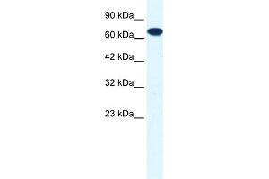 WB Suggested Anti-ZNF179 Antibody Titration:  0. (RNF112 anticorps  (C-Term))