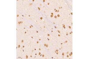 Immunohistochemistry of paraffin embedded rat brain using NAIF1 (ABIN7074867) at dilution of 1:2500 (400x lens)