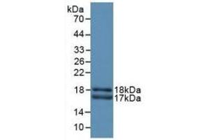 Detection of Recombinant CEACAM1, Rat using Polyclonal Antibody to Carcinoembryonic Antigen Related Cell Adhesion Molecule 1 (CEACAM1) (CEACAM1 anticorps  (AA 36-145))