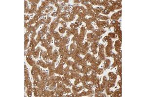 Immunohistochemical staining of human liver with MAGEB17 polyclonal antibody  shows strong cytoplasmic positivity in hepatocyte at 1:50-1:200 dilution. (MAGEB17 anticorps)