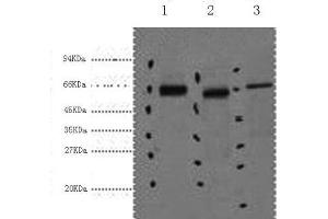 Western Blot analysis of 1) Hela, 2) Mouse kidney, 3) Mouse brain using CK-7 Monoclonal Antibody at dilution of 1:2000. (Cytokeratin 7 anticorps)