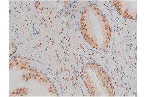 ABIN6267411 at 1/200 staining Human prostate tissue sections by IHC-P.