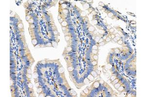 ABIN6266329 and ABIN6276659 at 1/100 staining Rat colon tissue by IHC-P.