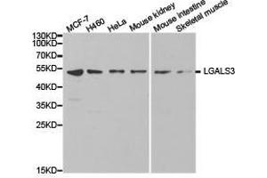 Western Blotting (WB) image for anti-Galectin 3 (LGALS3) antibody (ABIN1873541) (Galectin 3 anticorps)