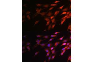 anti-Neurofilament, Heavy Polypeptide (NEFH) (AA 821-1020) antibody