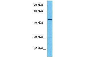 Host:  Mouse  Target Name:  YY1  Sample Tissue:  Mouse Brain  Antibody Dilution:  1ug/ml (YY1 anticorps  (Middle Region))