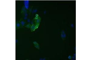 Immunofluorescence analysis on ETAR protein fused with 9A2 epitope tag. (HCV 1b NS5B anticorps  (AA 111-130))