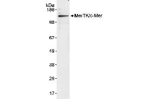 Western Blotting (WB) image for anti-C-Mer Proto-Oncogene Tyrosine Kinase (MERTK) (AA 200-250) antibody (ABIN7449268)