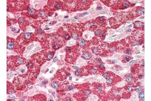 Human Liver (formalin-fixed, paraffin-embedded) stained with CTSDat 10 µg/ml followed by biotinylated goat anti-rabbit IgG secondary antibody, alkaline phosphatase-streptavidin and chromogen. (Cathepsin D anticorps)