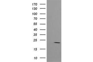 Image no. 2 for anti-HRas proto-oncogene, GTPase (HRAS) antibody (ABIN1498716) (HRAS anticorps)
