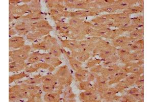 IHC image of ABIN7175376 diluted at 1:225 and staining in paraffin-embedded human heart tissue performed on a Leica BondTM system.
