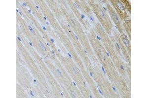 Immunohistochemistry of paraffin-embedded Mouse heart using USP25 Polyclonal Antibody at dilution of 1:100 (40x lens).
