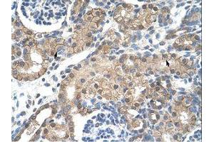 Image no. 1 for anti-Cholinergic Receptor, Nicotinic, beta 2 (Neuronal) (CHRNB2) (AA 155-204) antibody (ABIN203338)