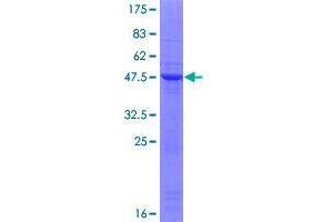 Image no. 1 for TIP41-like protein (TIPRL) (AA 1-178) protein (GST tag) (ABIN1322810)