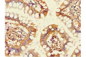 Immunohistochemistry of paraffin-embedded human small intestine tissue using ABIN7143191 at dilution of 1:100