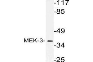 Western blot (WB) analysis of MEK-3 antibody in extracts from Jurkat cells. (MAP2K3 anticorps)