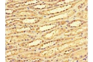 Immunohistochemistry of paraffin-embedded human kidney tissue using ABIN7149476 at dilution of 1:100 (DACH1 anticorps  (AA 166-369))