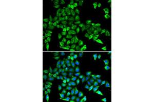 Immunofluorescence analysis of HeLa cells using CST3 antibody. (CST3 anticorps)