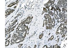 IHC analysis of HOXD11 using anti-HOXD11 antibody (ABIN7603174).