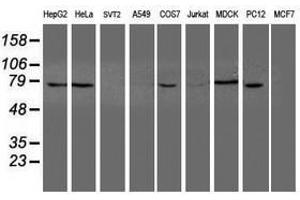 Image no. 5 for anti-Negative Regulator of Ubiquitin-Like Proteins 1 (NUB1) (AA 1-326) antibody (ABIN1490743)