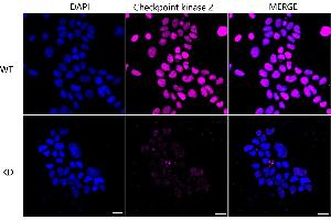 Immunocytochemical staining of Hela cells using Checkpoint kinase 2 antibody (ABIN7798040), 1:1,000), Top panel: wild-type (WT), Bottom panal: Checkpoint kinase 2 shRNA knockdown (KD). (Recombinant CHEK2 anticorps)
