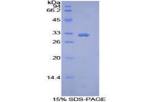 SDS-PAGE (SDS) image for Pyruvate Dehydrogenase Kinase, Isozyme 4 (PDK4) (AA 73-316) protein (His tag) (ABIN1877525)
