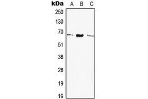 Western blot analysis of Elastin expression in HEK293T (A), SP2/0 (B), H9C2 (C) whole cell lysates. (Elastin anticorps  (Center))