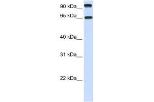 NTRK3 antibody used at 1 ug/ml to detect target protein. (NTRK3 anticorps  (C-Term))