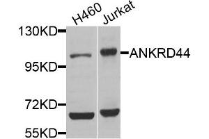 Western blot analysis of extracts of H460 and Jurkat cells, using ANKRD44 antibody. (ANKRD44 anticorps)