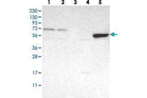 Western blot analysis of Lane 1: RT-4, Lane 2: U-251 MG, Lane 3: Human Plasma, Lane 4: Liver, Lane 5: Tonsil with FAM73A polyclonal antibody  at 1:250-1:500 dilution. (FAM73A anticorps)
