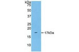 Detection of Recombinant KLRB1, Human using Polyclonal Antibody to Cluster Of Differentiation 161 (CD161)